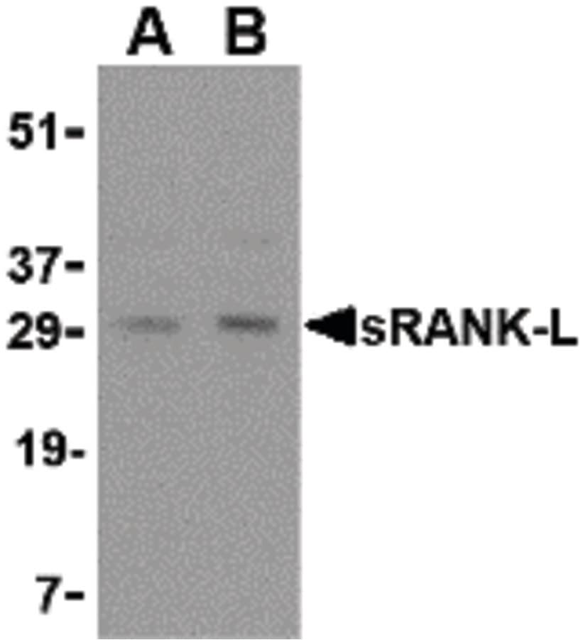 IHC-plus™ TNFSF11 / RANKL / TRANCE Antibody