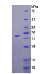 Human GM2A Protein (Recombinant His-T7)