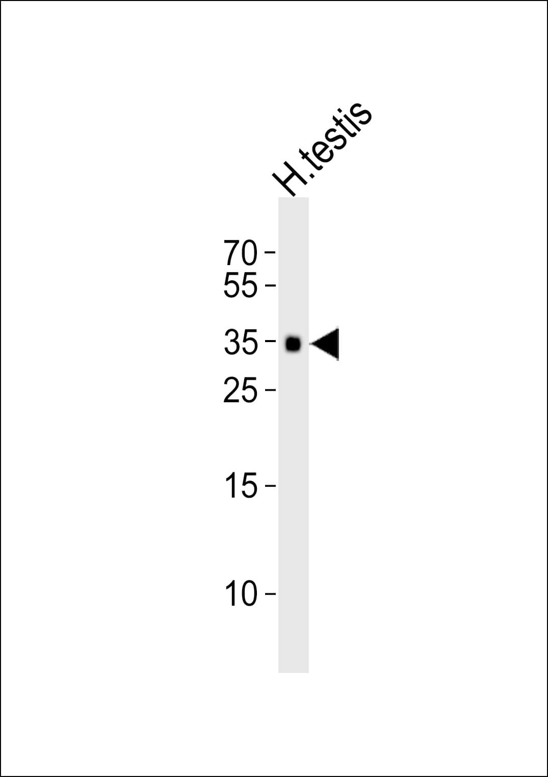 TEX101 Antibody (aa214-246)