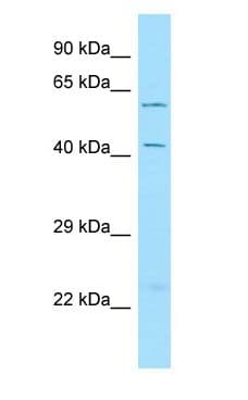 LRRTM3 Antibody (aa456-505)