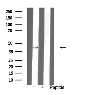 AURKB / Aurora-B Antibody