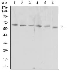 HAVCR1 / KIM-1 Antibody (clone 3D9F5)