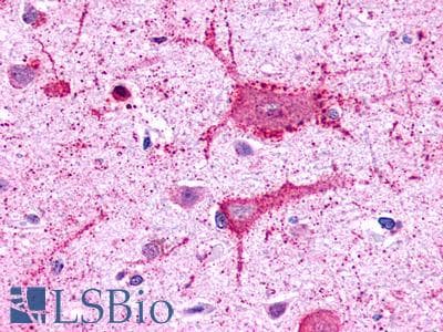 PathPlus™ Polyclonal Rabbit anti-Human GALR3 / Galanin Receptor 3 Antibody (C-Terminus, IHC)