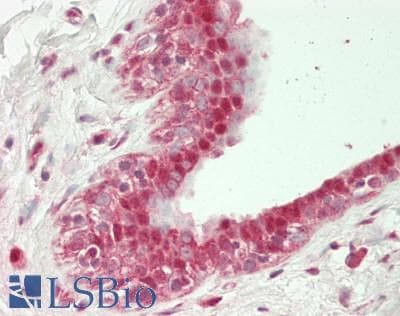 IHC-plus™ Polyclonal Rabbit anti-Human UBA1 / UBE1 Antibody (aa800-850, IHC, WB)