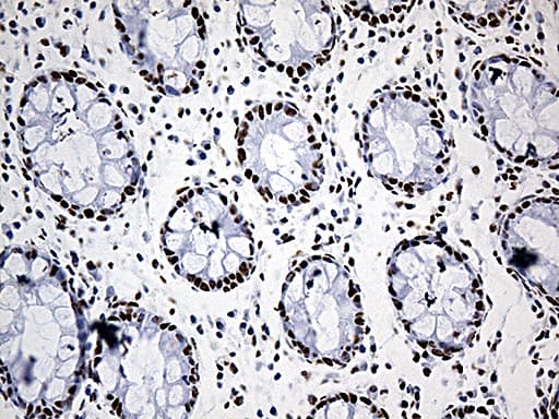 Monoclonal Mouse anti-Human DDX39B / UAP56 Antibody (clone OTI8B8, aa319-428, IHC, WB)