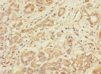 TMOD1 / Tropomodulin 1 Antibody