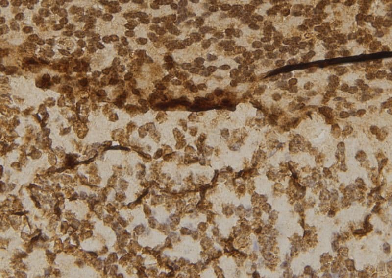 CBLB Antibody