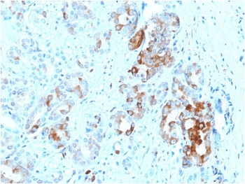 Monoclonal Mouse anti-Human FTL / Ferritin Light Chain Antibody (clone FTL/1387, Azide-free,BSA-free, IHC, WB)