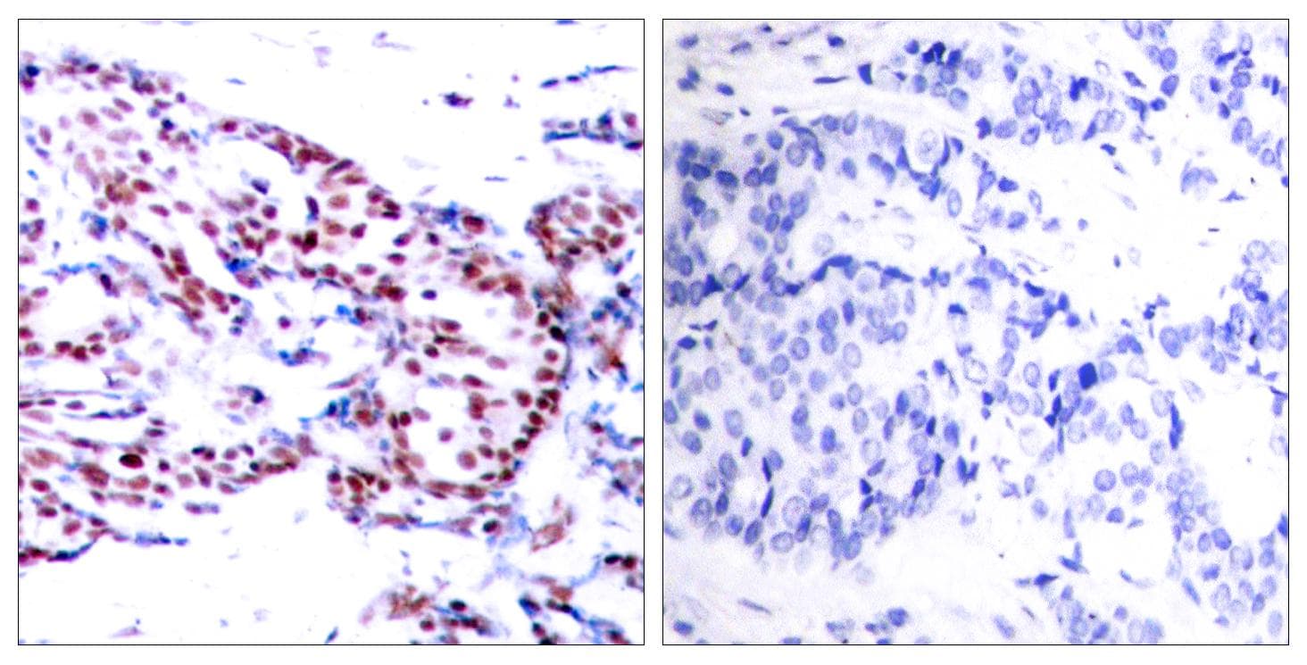 ATF2 Antibody (p71 or 53)
