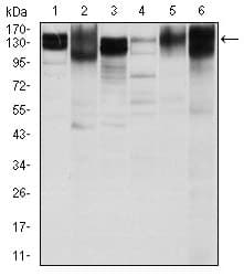 ITGB1 / Integrin Beta 1 / CD29 Antibody (clone 3B6)