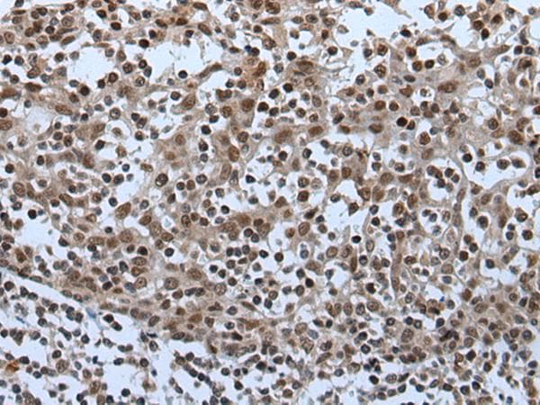 Polyclonal Rabbit anti-Human BRUNOL5 / CELF5 Antibody (IHC)