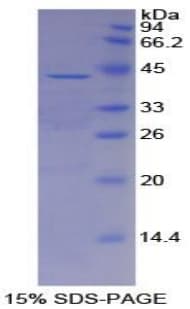 Human AHSG / Fetuin A Protein (Recombinant His)