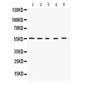 KCNA3 / Kv1.3 Antibody (aa513-544)
