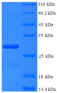 Human C11 / POLR3K Protein (Recombinant His-SUMO)
