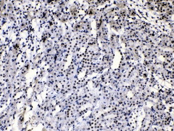 HNRPA1 / HnRNP A1 Antibody