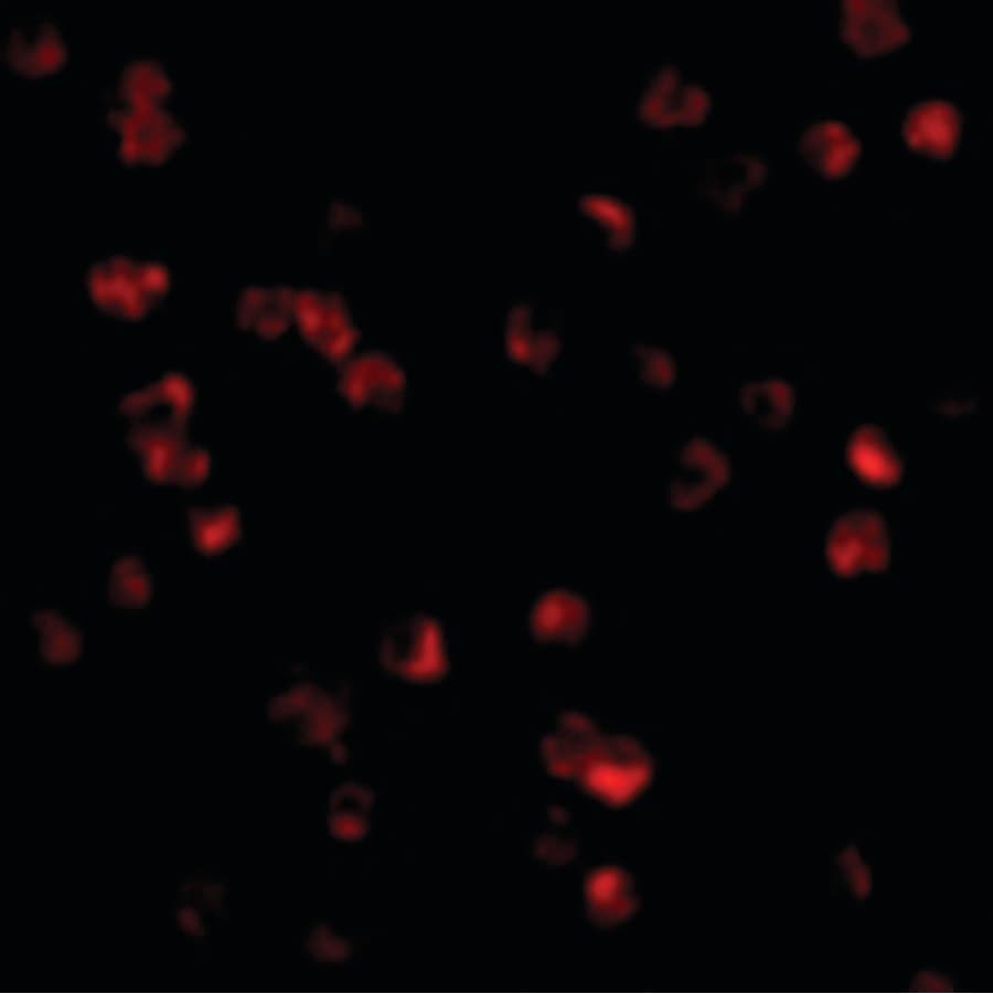 IHC-plus™ Polyclonal Rabbit anti-Human TLR8 Antibody (IHC, IF, WB)