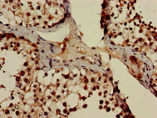 POT1 Antibody