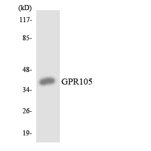 Polyclonal Rabbit anti-Human P2RY14 / GPR105 Antibody (aa138-187, WB)