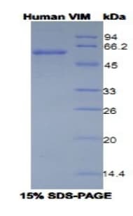 Human Vimentin Protein (Recombinant His, N-Terminal)