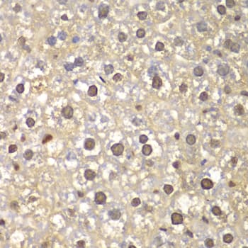 FEN1 Antibody