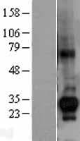 CTDSP1 / SCP1 Protein (Over-Expression Lysate Myc-DDK (Flag))