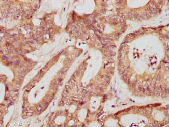MMP3 Antibody