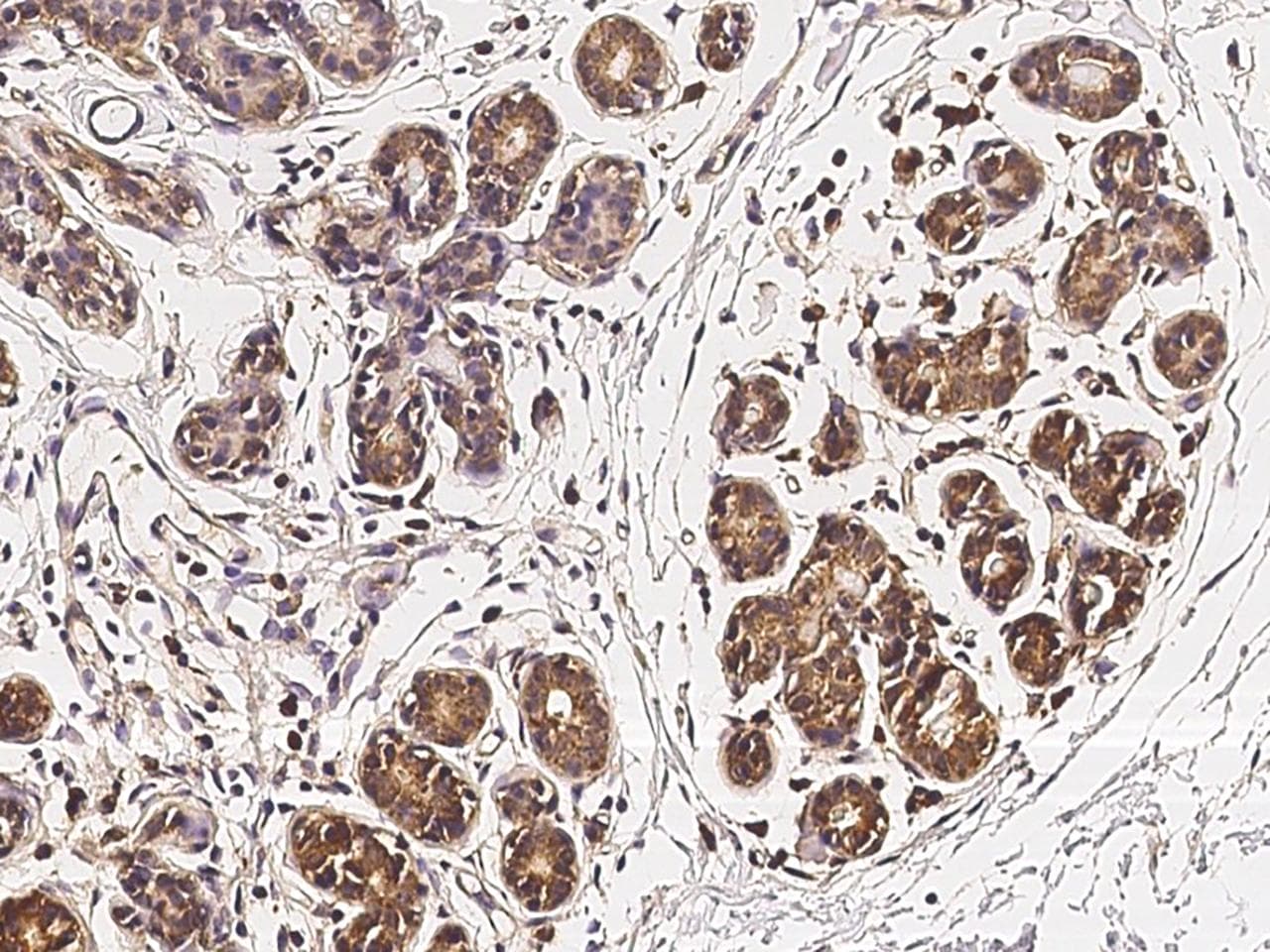 ZNF879 Antibody