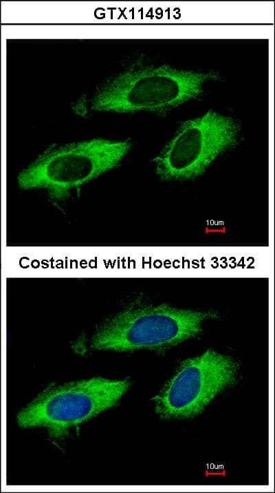 Polyclonal Rabbit anti-Human RPL6 / Ribosomal Protein L6 Antibody (IHC, IF, WB)
