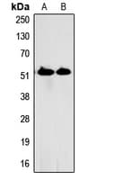 Polyclonal Rabbit anti-Human SPTLC1 / HSN1 Antibody (C-Terminus, WB)