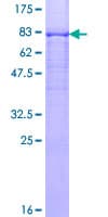 Human PPP3CB Protein (Recombinant GST)