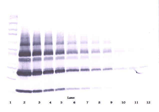 PGF / PLGF Antibody