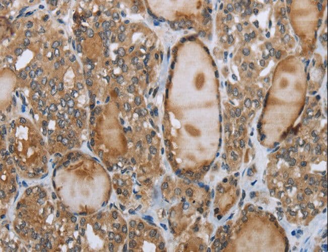 GGT1 / GGT Antibody (aa1-225)