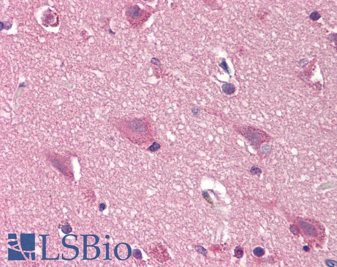 IHC-plus™ Polyclonal Rabbit anti-Human DCK / Deoxycytidine kinase Antibody (N-Terminus, IHC, WB)