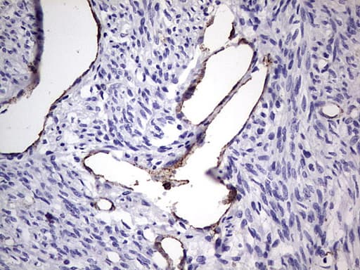 VWF / Von Willebrand Factor Antibody (aa764-1263, clone OTI7G3, Carrier-free)