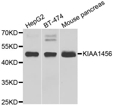 KIAA1456 / C8orf79 Antibody