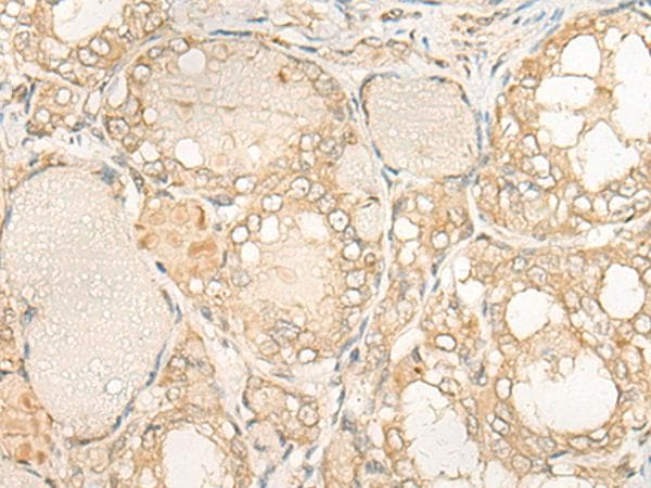 Polyclonal Rabbit anti-Human DUSP27 Antibody (IHC)
