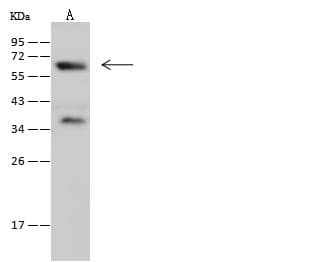 Polyclonal Rabbit anti-Mouse SYT1 / Synaptotagmin Antibody (Preservative Free, WB)
