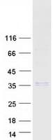 Human SHH / Sonic Hedgehog Protein (Recombinant Myc-DDK (Flag))
