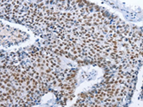 Polyclonal Rabbit anti-Human GNRH Antibody (IHC)