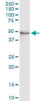 FADS3 Antibody (clone 3D2)