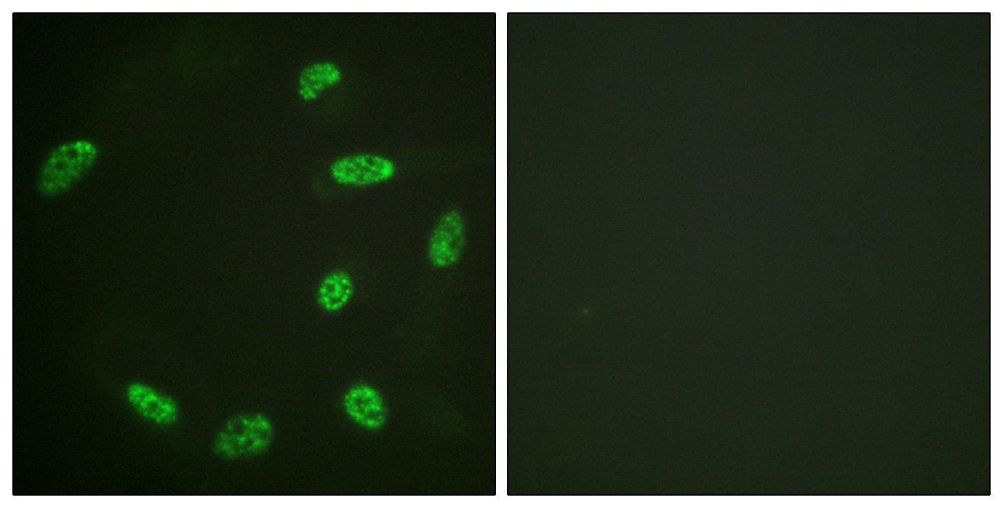 ERF / PE2 Antibody