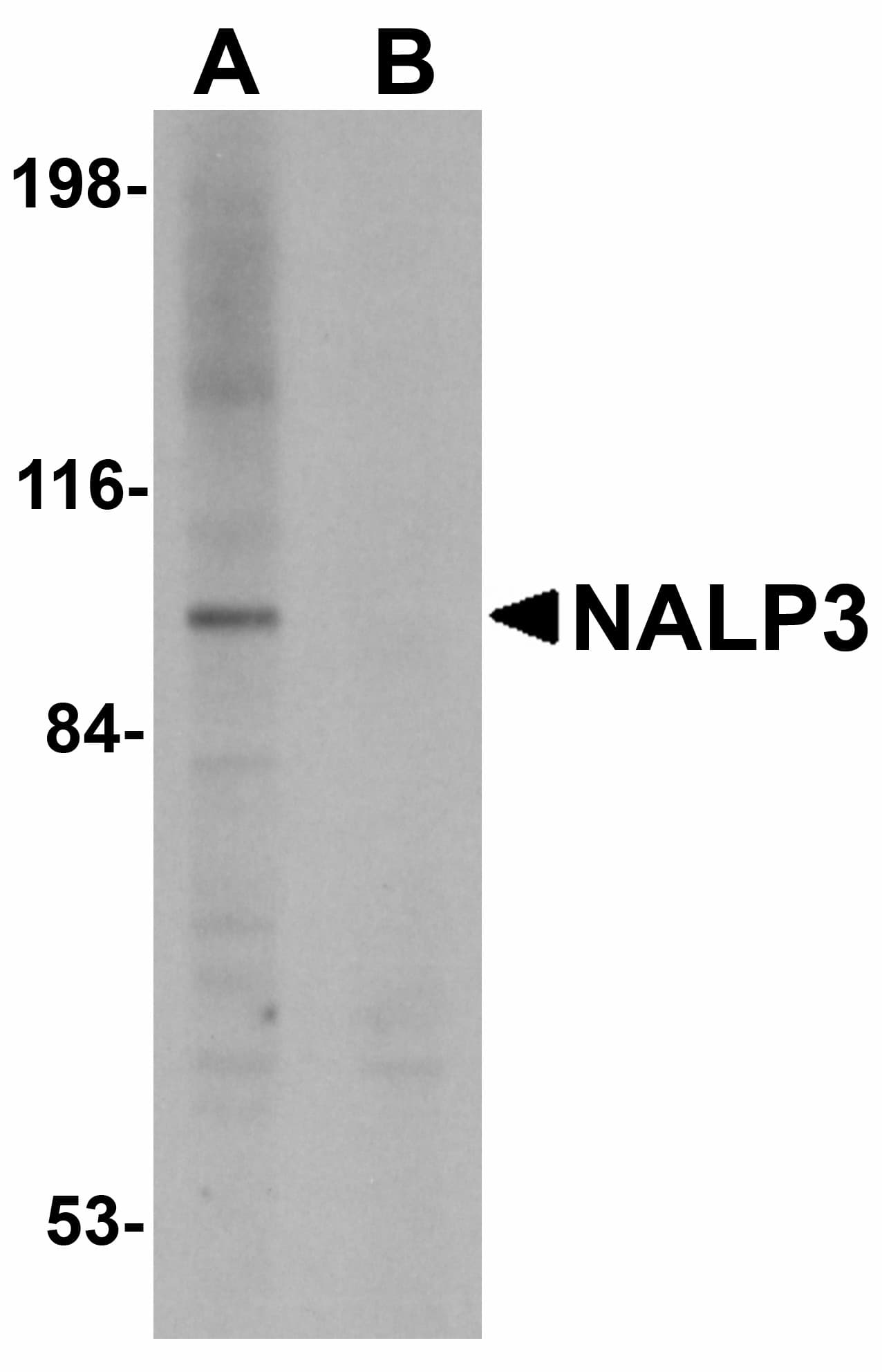 PathPlus™ NALP3 / NLRP3 Antibody