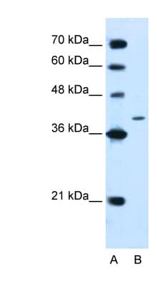 Polyclonal Rabbit anti-Human PTPN2 / TC-PTP Antibody (aa23-72, WB)