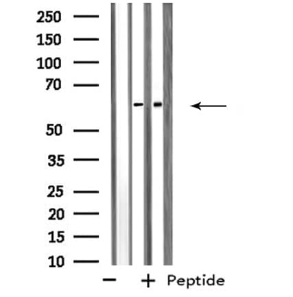 Polyclonal Rabbit anti-Human SNX1 Antibody (IF, WB)