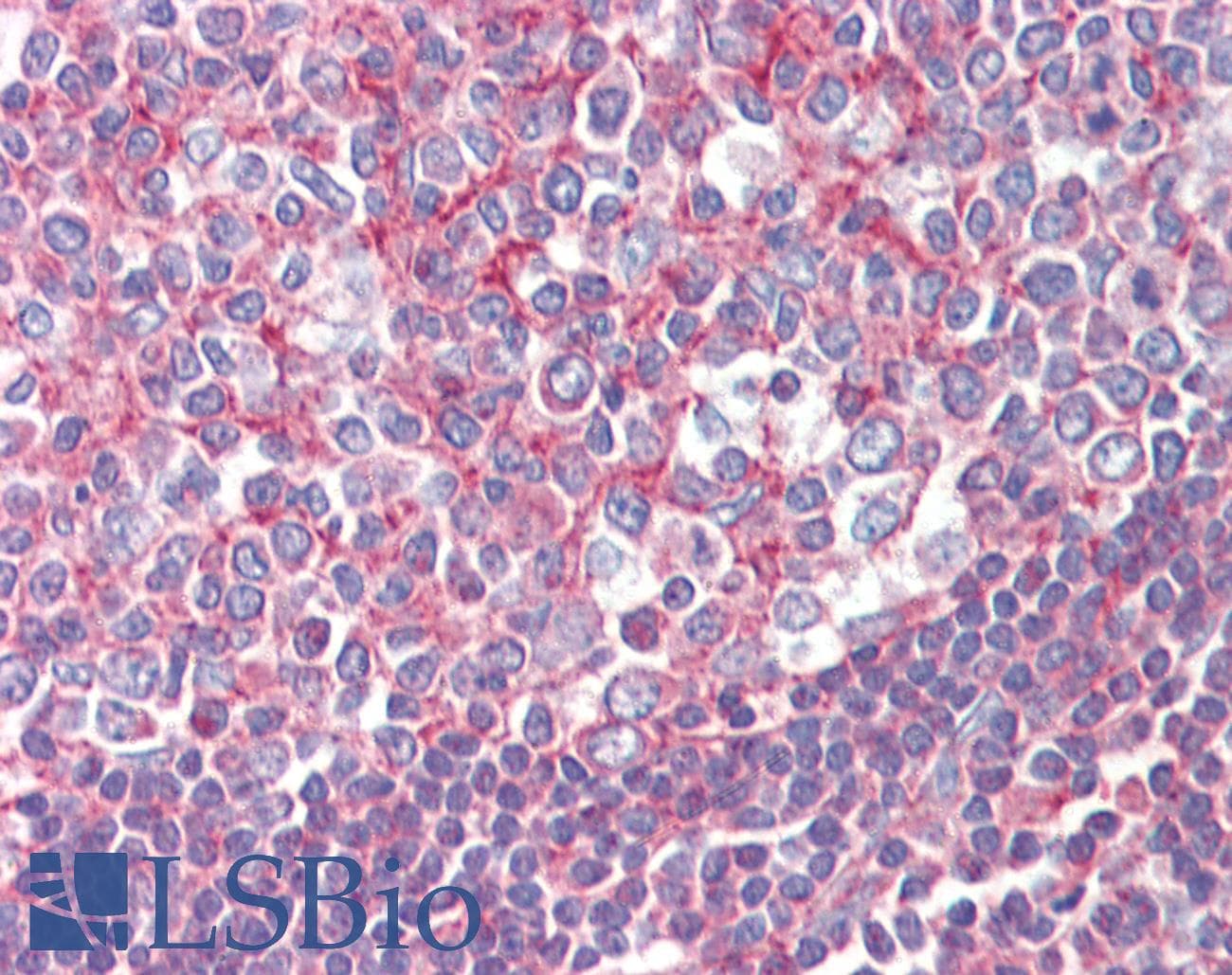 IHC-plus™ Polyclonal Goat anti-Human SEPT2 / Septin 2 Antibody (aa37-49, IHC, WB)