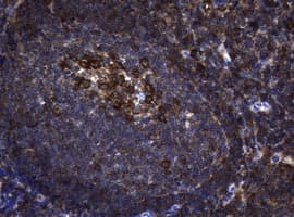 NME1 / NM23 Antibody (clone OTI24A2)