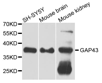 GAP43 Antibody