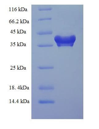 Human PDCD10 Protein (Recombinant His-SUMO)