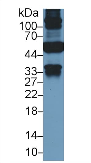 KRT19 / CK19 / Cytokeratin 19 Antibody (PE)
