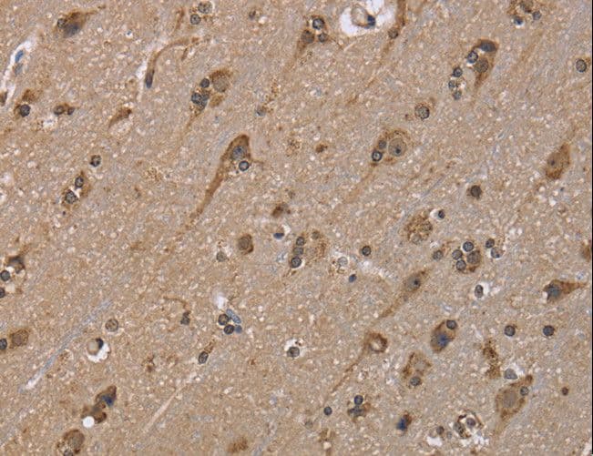 MYD118 / GADD45B Antibody